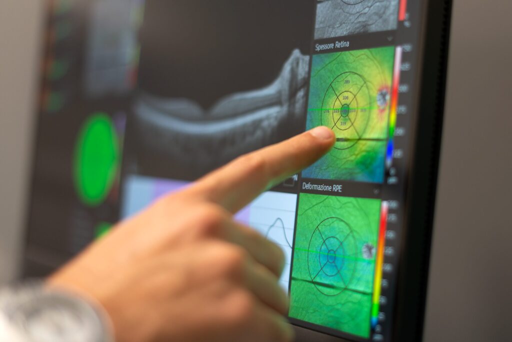 OCT per la diagnosi di maculopatie e glaucoma utilizzato dal Dott. Luca Zanolini, oculista a Brescia, Montichiari e Manerbio