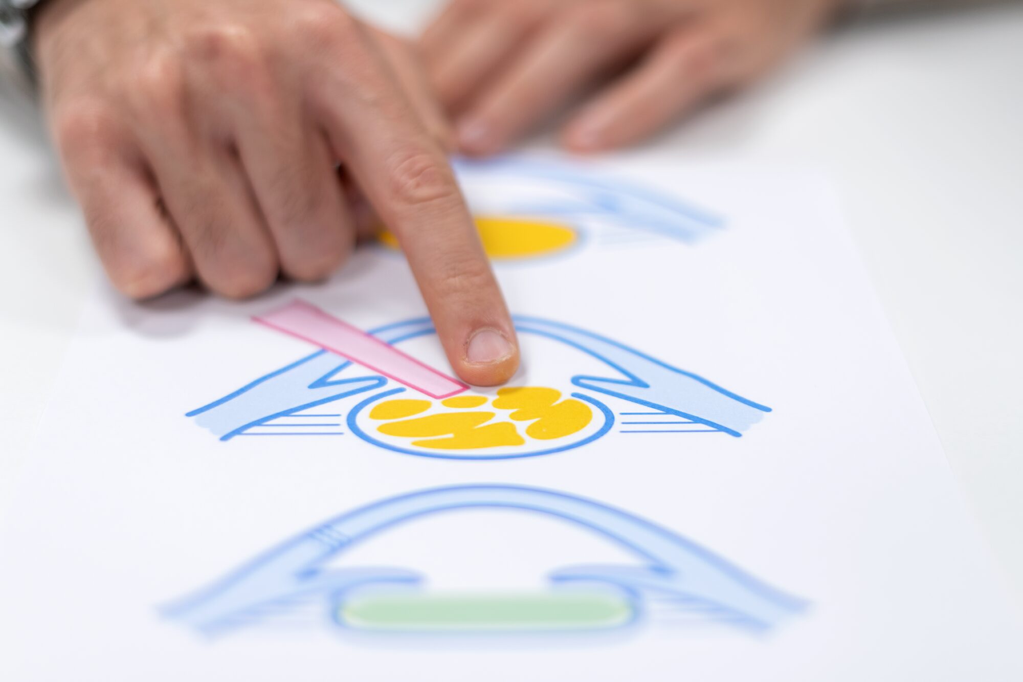 Cataratta: opacizzazione del cristallino. Studio oculistico con diagnostica avanzata del Dott. Luca Zanolini a Montichiari