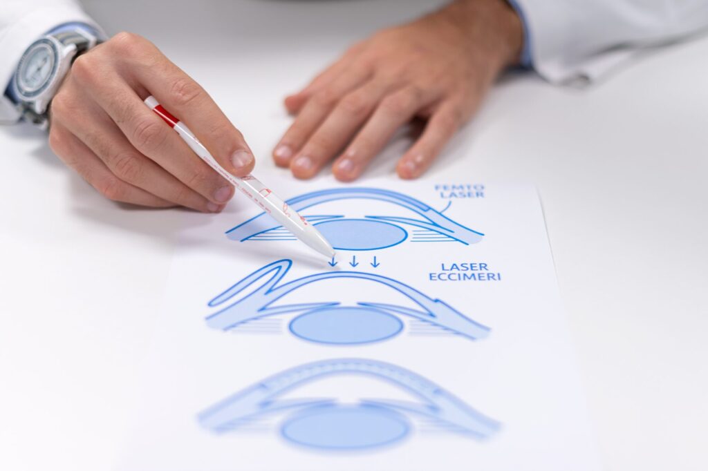 Chirurgia refrattiva