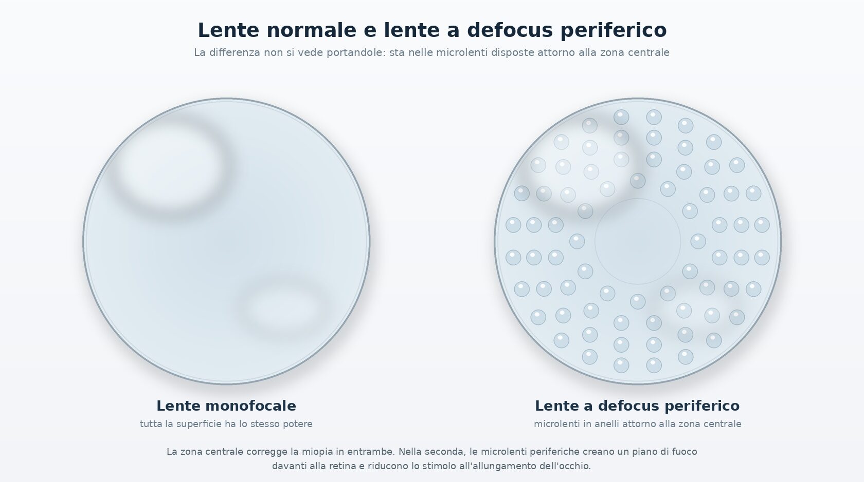 Due lenti da occhiale viste di fronte a confronto: a sinistra una lente monofocale con superficie uniforme, a destra una lente a defocus periferico con la zona centrale libera e numerose microlenti disposte in anelli concentrici nella parte periferica